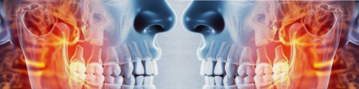 TMJ Trigger Point Therapy